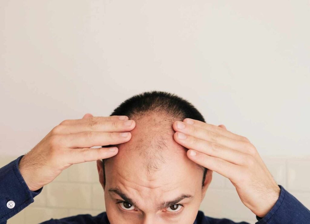 Is this the end of baldness? This stock jumps 50% on breakthrough